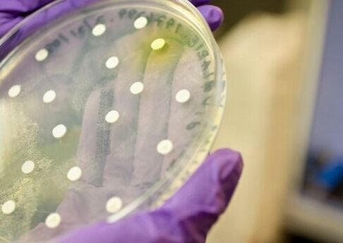 бактериална култура за диагностика на простатит